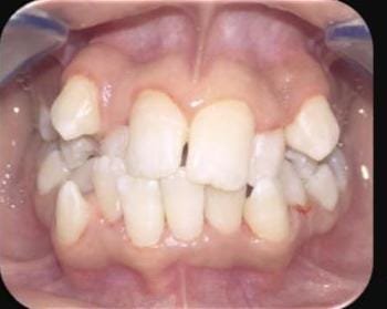 before image