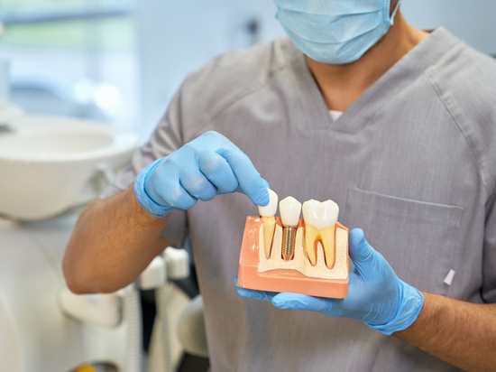 زراعة الأسنان